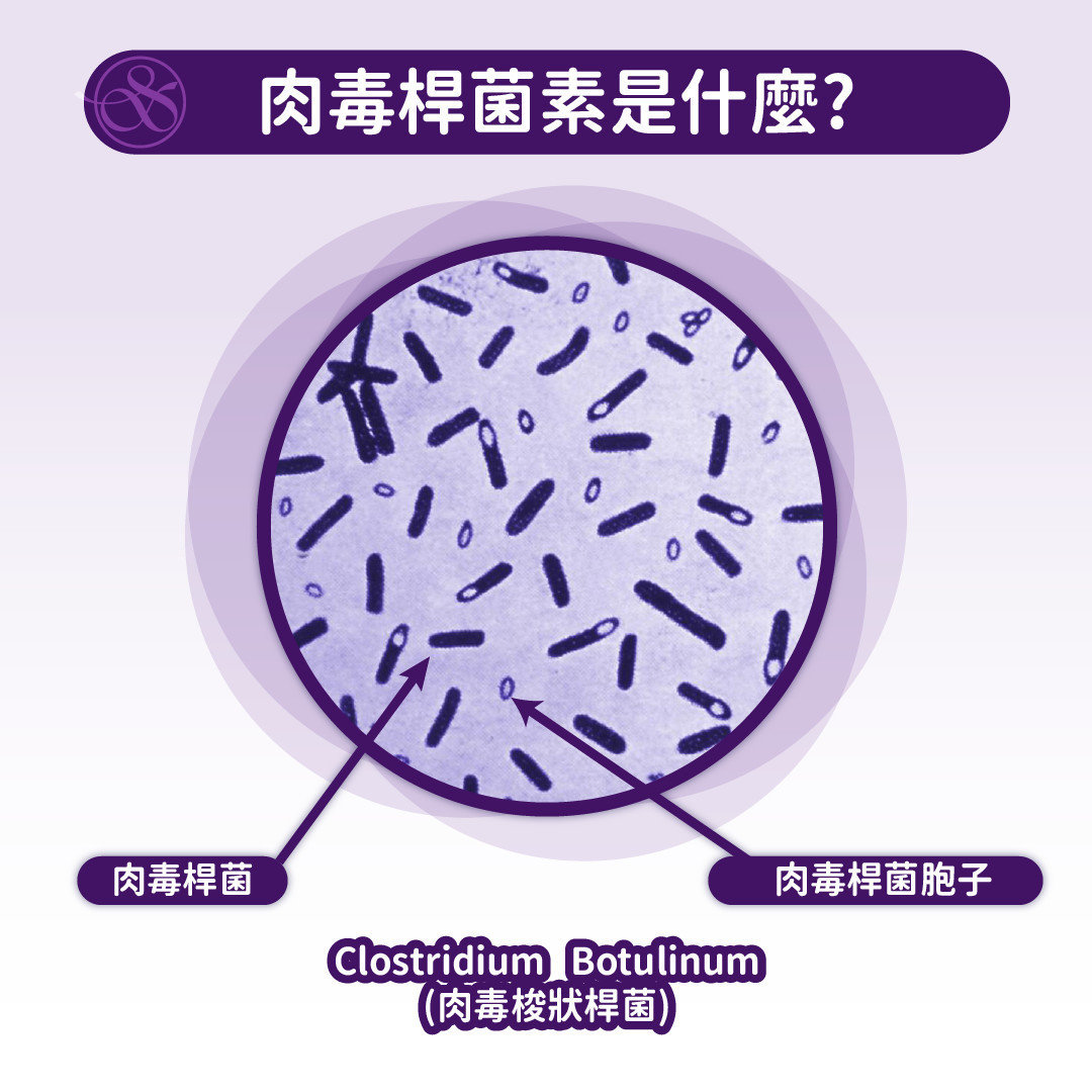 肉毒桿菌是什麼 肉毒桿菌知多少 肉毒桿菌原理介紹